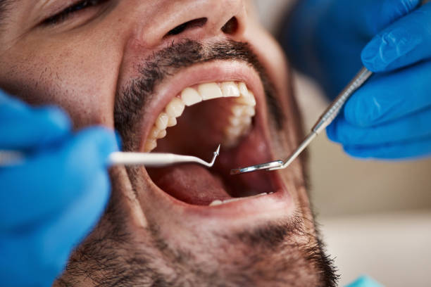 Best Emergency Tooth Extraction  in Sardinia, OH