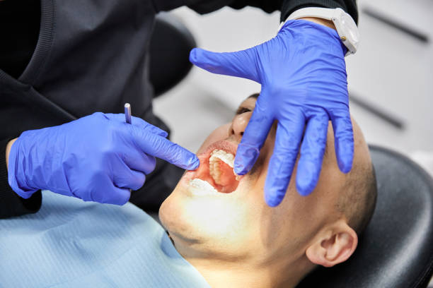 Best Root Canal Emergency Dentist  in Sardinia, OH