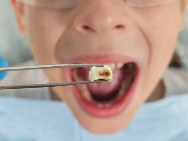Best Emergency Tooth Extraction  in Sardinia, OH